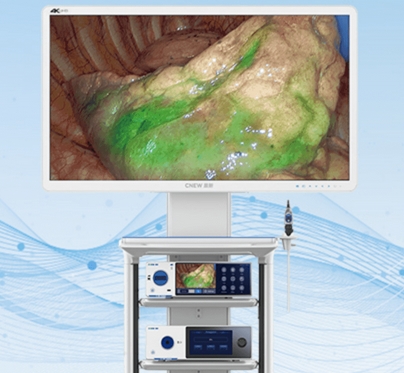 CN-FE102-FM100 晨新內(nèi)窺鏡熒光攝像系統(tǒng)